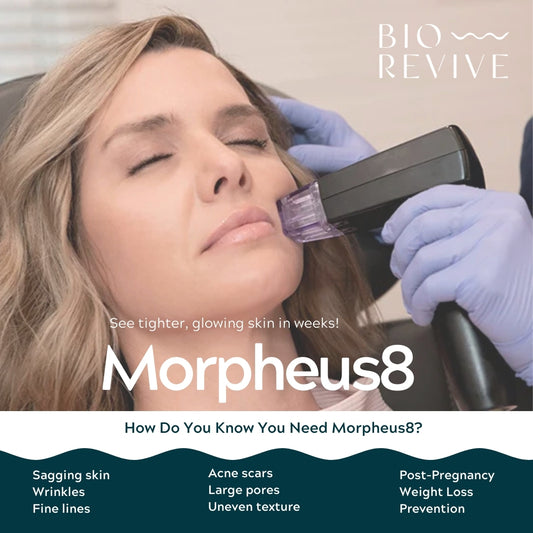 Morpheus8 Burst | Full Face & Neck | 50% OFF | 1st Treatment Offer
