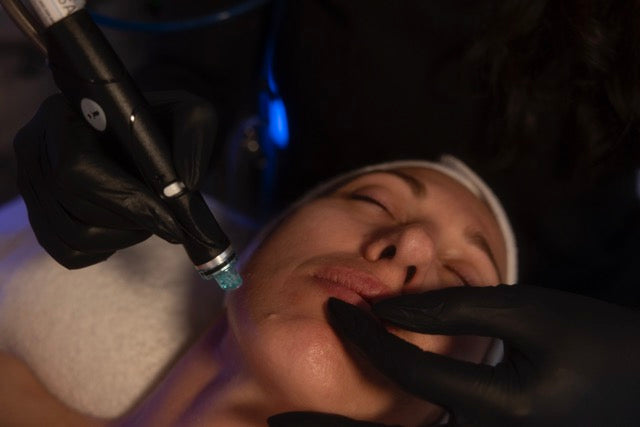 Hydrafacial™