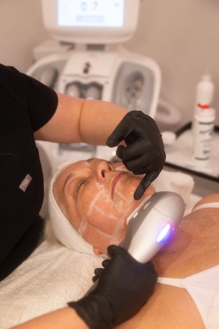 Tratamiento de lifting facial sin cirugía: HIFU 7D en cuello y mandíbula