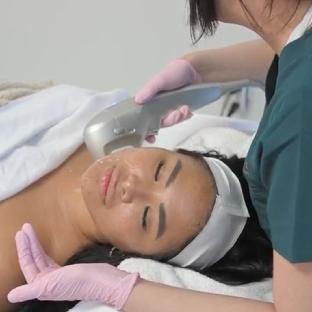 HIFU Newport Beach | Non-Surgical Facelift Treatment – BioRevive