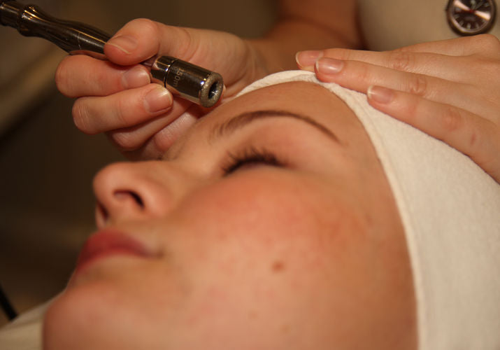 Microdermabrasion (MDA) treatment