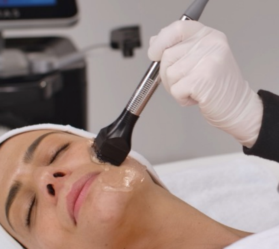 FORMA Skin Tightening | 1st Treatment Offer