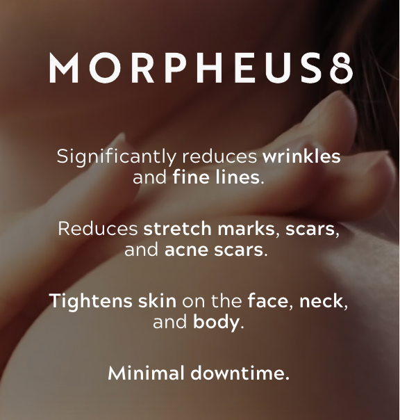 Morpheus8 Burst | Full Face | 60% OFF | 1st Treatment Offer