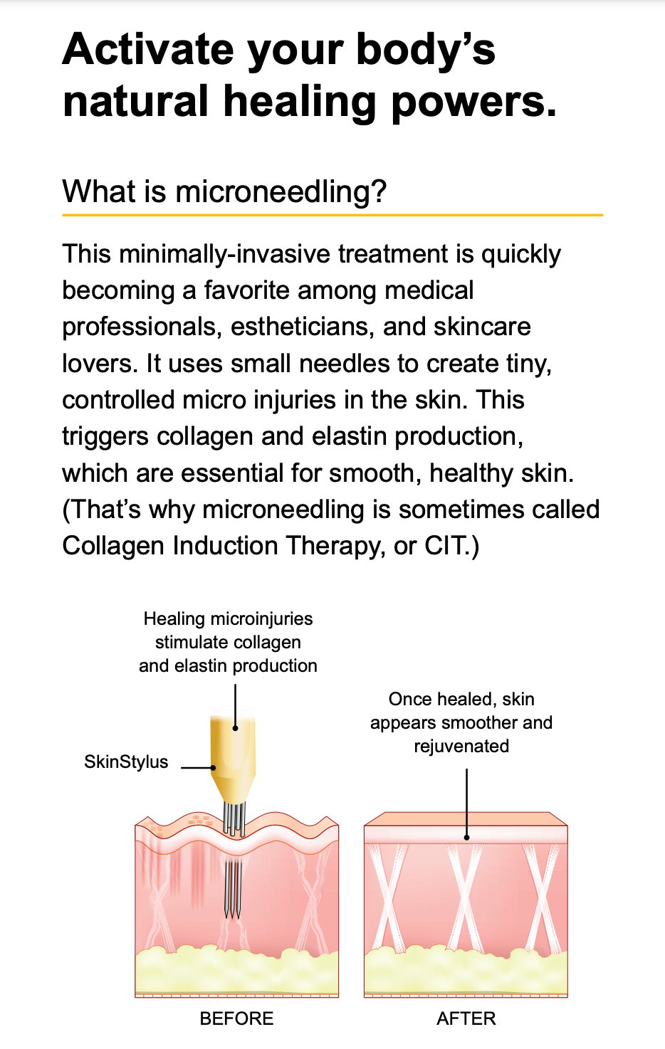 SkinStylus™ Microneedling Treatment