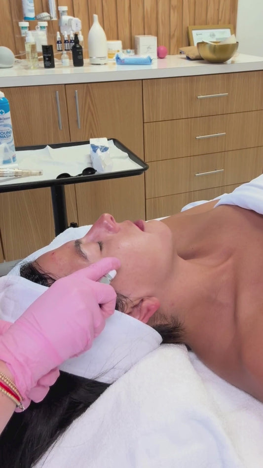 SkinStylus™ Microneedling Treatment  | 1st treatment promo