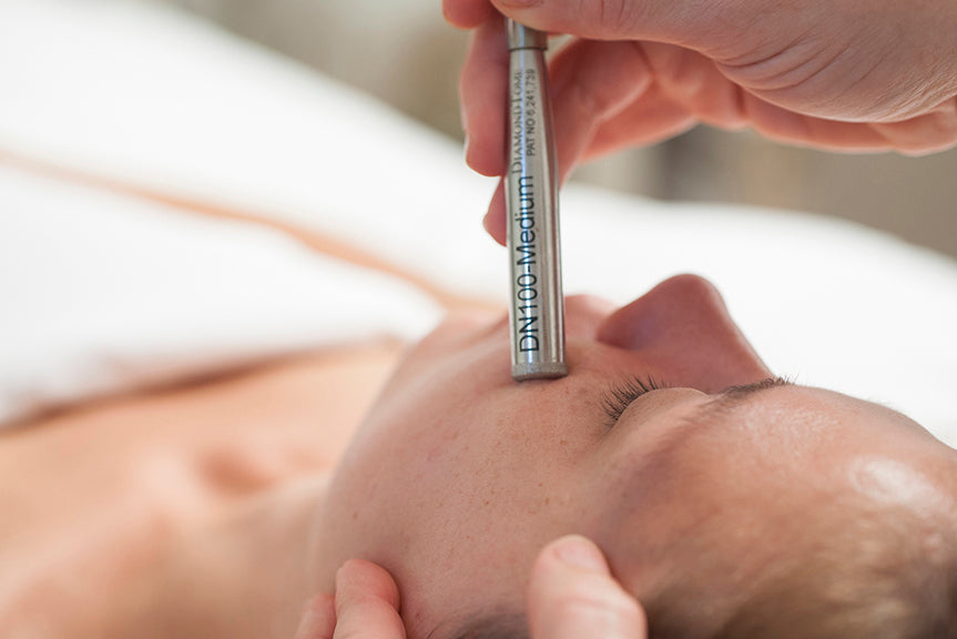 Microdermabrasion (MDA) treatment