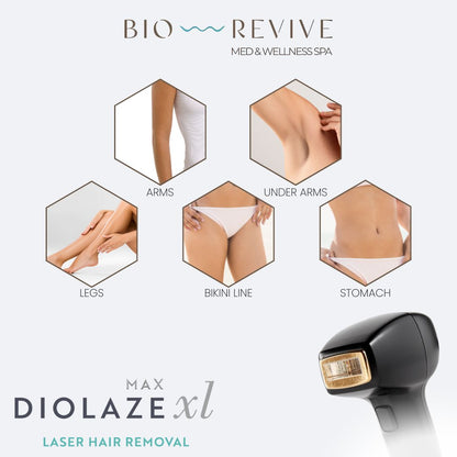 Laser Hair Removal in Newport Beach – Smooth, Lasting Results