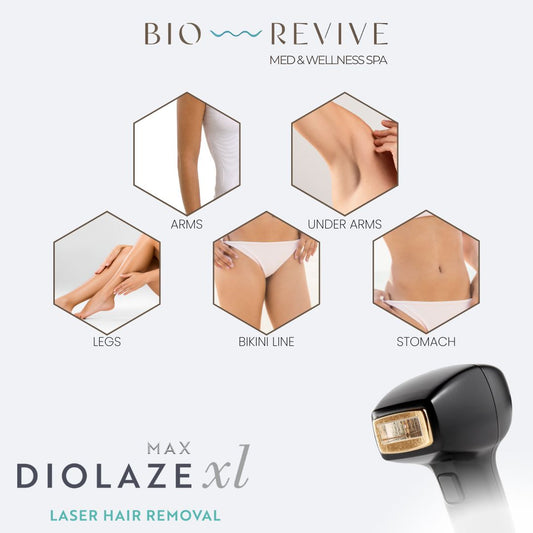 Laser Hair Removal in Newport Beach – Smooth, Lasting Results
