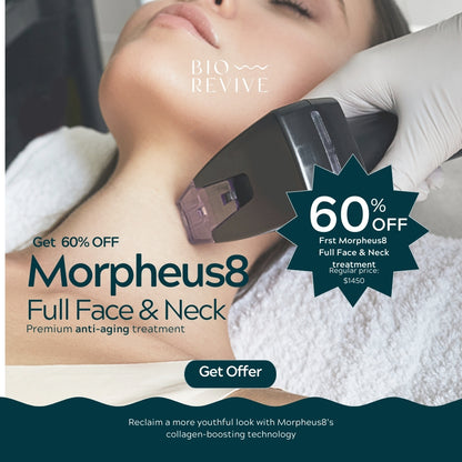 Morpheus8 Burst | Full Face & Neck | 60% OFF | 1st Treatment Offer