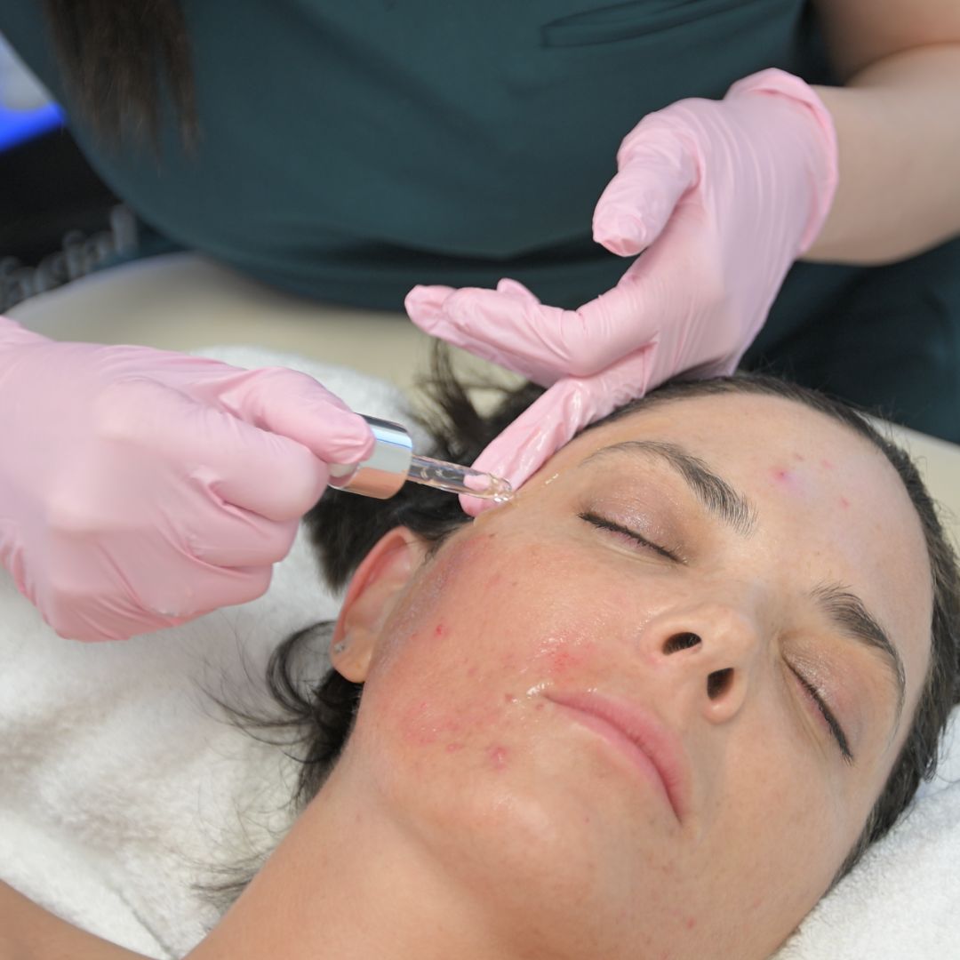 Exosome Treatment in Newport Beach