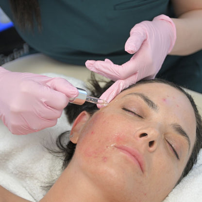 Exosome Treatment in Newport Beach