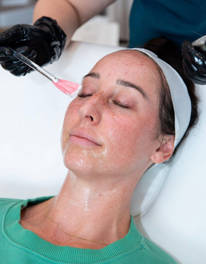 ZO 3-Step Peel hero image — Ponte Vedra, FL