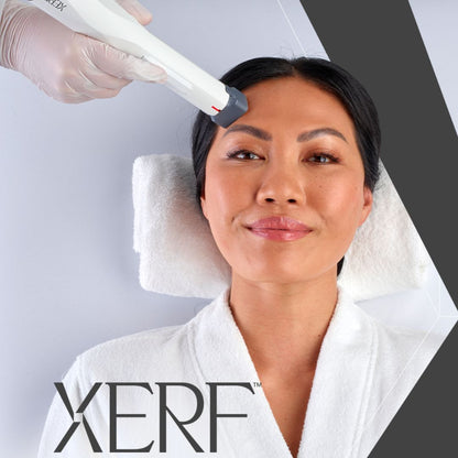 XERF