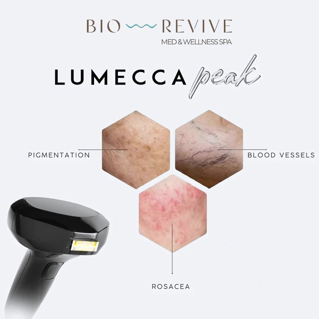Lumecca Peak IPL