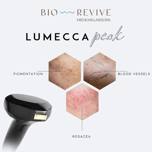 Lumecca Peak IPL