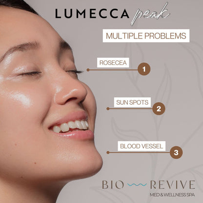Promo Lumecca IPL