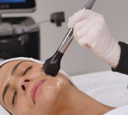 FORMA - Non-Surgical Radiofrequency Treatment for Wrinkles