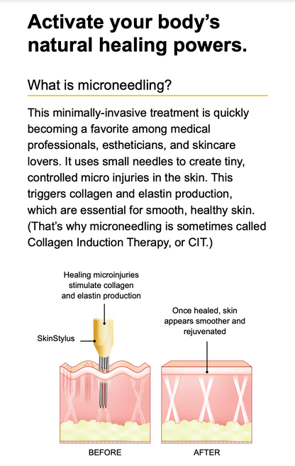 SkinStylus™ Microneedling Treatment  | 1st treatment promo