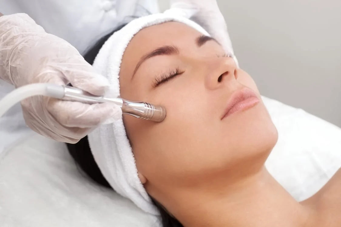 Microdermabrasion - First Visit Client Limited Time Offer